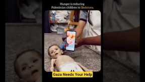 GAZA CHILDREN REDUCED TO SKELETON DUE TO CRISIS #shorts#viral #trendingnow #gazachildren #gazacrisis