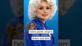 Celebrities with Failed Plastic Surgery,before and after.#celebrity  #entertainment #usa