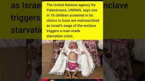 🔴Breaking News: 1 in 10 Gaza Children Starving | UN Confirms Hunger Crisis #breakingnews