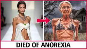 25 Celebrities You Won't Believe DlED OF ANOREXlA | Try Not to Gasp at Them Today!