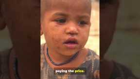 Gaza Famine: UN’s Shocking Warning | Gaza Turns Into a Famine Zone | Global Crisis Explained