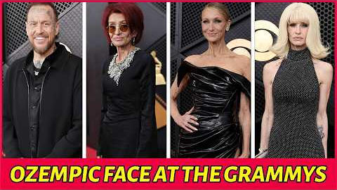 22 Celebrities With Shocking Grammys 2026 Transformations — Ozempic Face?
