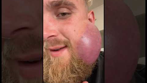 Jake Paul Jaw Getting Worse 😞 #jakepaul #viral #funny #boxing