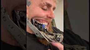 Jake Paul New Jaw Broken Update!? 💔 #jakepaul #viral #funny #boxing #breakingnews