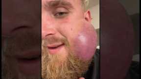 Jake Paul Jaw Getting Worse 😞 #jakepaul #viral #funny #boxing