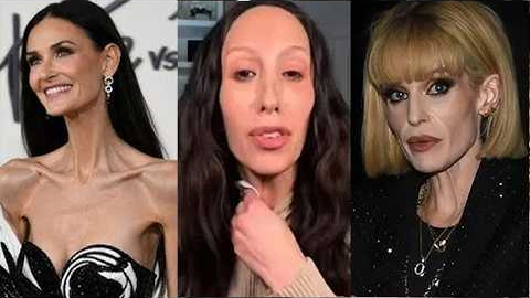 These Celebrity Ozempic Transformations Have Fans Seriously Concerned