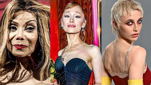 Celebrities RUINING Their Faces, Relationships & Careers (It Gets Worse…)