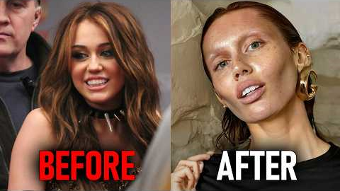 Celebrities Who COMPLETELY RUINED Their Faces Trying To Stay YOUNG