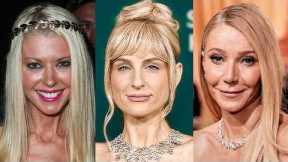 Before and After Photos Of Celebrities With The UGLIEST Ozempic Face