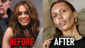 Celebrities Who COMPLETELY RUINED Their Faces Trying To Stay YOUNG
