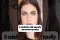 6 celebrities with naturallyuncommon