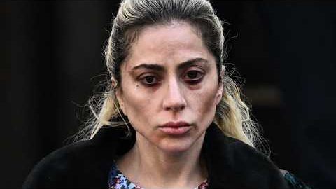 NEW Photos Show Celebrities SUFFERING With Ozempic Eyes